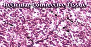 The fibers are thin branching structures. Reticular Connective Tissue Assignment Point