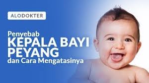 Masalah kepala peyang tidak terjadi sejak lahir tapi setelah bayi lahir dan menerima beberapa perlakuan. Ini Penyebab Kepala Bayi Peyang Dan Cara Mengatasinya Alodokter