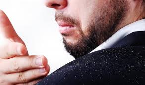 How to scratch psoriasis on scalp !! How To Solve The Biggest Problem Of Scalp Dandruff Aisclinic