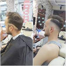 Gumus Makas Adam Bakim Merkezi Ilkadim Samsun 0 552 409 25 Birmilyonnokta