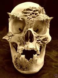 Pin By Cher Marino On Skulls Skull Art Skull Human Oddities