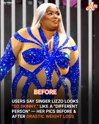 LIZZO! IS THAT YOU?😳," one user asked in astonishment. The singer's photos  before & after her WEIGHT-LOSS TRANSFORMATION are in the comments.👇