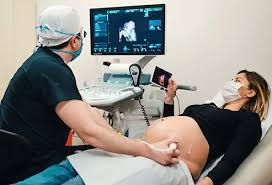 Image result for External Cephalic Version