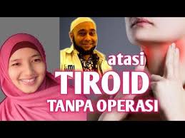Atasi Penyakit Tiroid Tanpa Operasi Resep Jsr Dr Zaidul Akbar Penyakit Tiroid Biidznillah Youtube Di 2020 Penyakit Tiroid Tiroid Penyakit