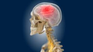 (eds) medikamentös induzierte neurologische und psychiatrische störungen. Sinusthrombose Europaische Leitlinie Zur Sinusvenenthrombose Vorgestellt Springermedizin De