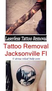 Sharing my laser tattoo removal experience! Custom Tattoo Tattoo Removal Price Range How To Remove Tattoos Naturally At Home Picosure The Laserless Tatto Laser Tattoo Tattoo Removal Cost Tattoo Removal