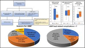 350,641 likes · 7,736 talking about this. Pros And Cons Of Left Bundle Branch Pacing Circulation Arrhythmia And Electrophysiology