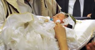 يا عريس يا صغير علقة تفوت ولا حد يموت ختان الذكور من الفراعنة حتى الآن تركيا تحتفل بالرقص والجزائر بالقميص الأبيض أم المطاهر فى مصر بزفة الحصان وجراح 5 حالات تؤخر العملية