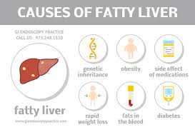 What Is Fatty Liver Fatty Liver Liver Disease Fatty Liver Disease