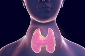 Image result for Hyperthyroidism