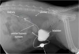 Surgery to either remove bladder stones or urinary catheter or surgery to remove urethral blockage in male cats. Ureter Bypass System For Treatment Of Ureteric Obstruction