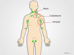 How To Check Lymph Nodes Lymph Nodes Lymph Glands Cancer Sign