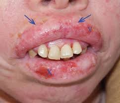 Image result for Oncinotis