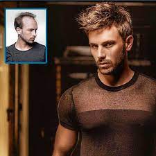 Demo Hair Protez Sac Ile Ozlem Duydugunuz Saclariniza Kavusmaniz Artik Mumkun Merkezimizde Uygulanan Protez Saclar 100 Insan Sac Hair System Hair Mens Tshirts