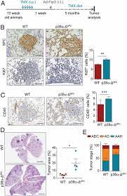 requirement for epithelial p38a in kras driven lung tumor progression pnas