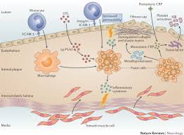 نتیجه جستجوی لغت [inflammatory] در گوگل
