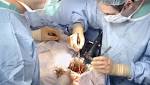  Study Aims To Show Transplants Between HIV-Positive Patients Are Safe, Save Lives