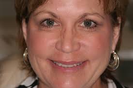 Dental Bridges & Crowns