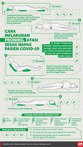 Maybe you would like to learn more about one of these? Infografis Cara Proning Atasi Sesak Napas Pasien Covid 19
