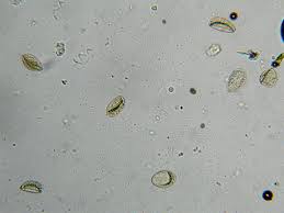 Tapeworms may leave egg packets stuck to the surface of the stool. Companion Animal Parasite Council Spirometra Spp