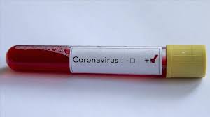 Die entsprechende verordnung wurde von der. Football 2 Bayern Munich Players Contract Coronavirus