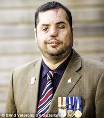 Ex-soldier who lost eye tries to find glass eye collection