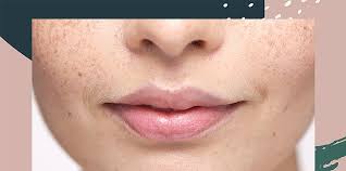 With sugaring, you need to pull the hair against the direction of the hair growth. Upper Lip Hair Removal How To Wax Your Upper Lip At Home Hellogiggles