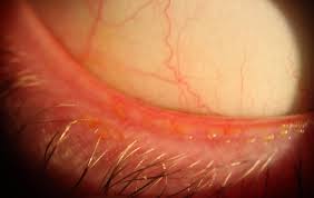 Image result for Blepharis gazensis