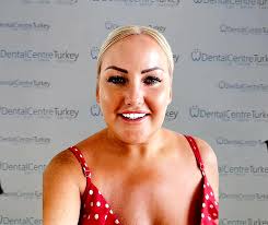 Has anyone just had there top set of teeth done (crowns) if so can I see  pictures? I go in April and really unsure if to get bottom and top set done