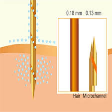 We did not find results for: Aquagold Microinfusion Treatment Micro Botox Facial Houston Belage Cosmetic Surgery Center