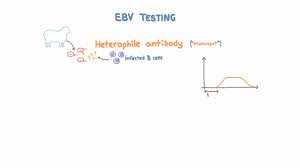 epstein barr virus ebv diagnosis and testing