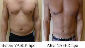 Only 1 out of 10 people even go to leave a review and they're . Before After Cosmetic Surgery Medical Face Body Aesthetics