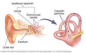 Illustration Showing The Inner Ear And Canalith Repositioning Diagnosis Tinnitus Retraining Therapy Vertigo