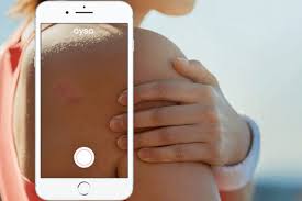 Rechazan tres recursos y avanza la pesquisa por sobornos con plantas potabilizadoras. This App Wants You To Stop Googling Your Skin Issues Carley K