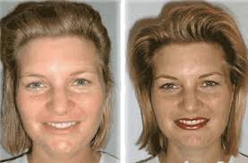 Wanda Enoch Cosmetic Enhancements