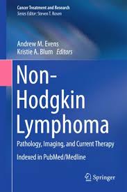 Lavender ribbon awareness for cancers. Non Hodgkin Lymphoma Springerlink