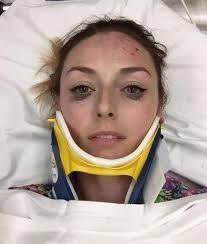 مازلنا نعجز عن فهم النساء 🥴 كتبت هذه السيدة على الانستجرام بعد أن رفعت تلك  الصورة : حدثت لي حادثة على الطريق، وانتقلت إلى المستشفى في سيارة الإسعاف،  وأجريت فحوصات مختلفة وأشعة