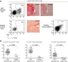 Aardvark ant & pest control inc. Abundant Numbers Of Regulatory T Cells Localize To The Liver Of Chronic Hepatitis C Infected Patients And Limit The Extent Of Fibrosis Journal Of Hepatology