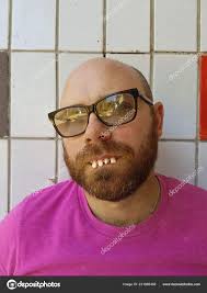 Skallet mann i briller med stygge tenner