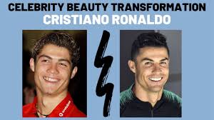 Cristiano ronaldo dos santos aveiro, wore braces to get his teeth straight. Cristiano Ronaldo Braces