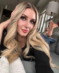 Say Hello, To Charlotte Everyone. She's Getting More & More Comfortable On  Me. New Holstein, WI.