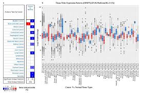 The different types of breast cancer include invasive ductal carcinoma, or breast cancer that favors the milk ducts of the breast. Biomedicines Free Full Text A Multi Omics Analysis Of Bone Morphogenetic Protein 5 Bmp5 Mrna Expression And Clinical Prognostic Outcomes In Different Cancers Using Bioinformatics Approaches Html