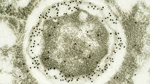 There is a good film on the other channel. A Living Library Filled With Killer Bacteria The New York Times