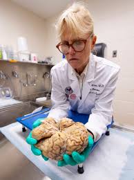 Cte_query_definition specifies a select statement whose result set populates the common table expression. Cte Unlocking A Diagnosis To Neurodegenerative Brain Disease