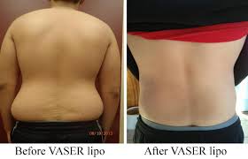 Medical face and body aesthetics is new england's choice for cosmetic surgery and aesthetic enhancements. Before After Cosmetic Surgery Medical Face Body Aesthetics