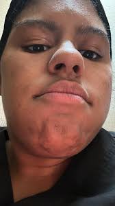 Please house help with idea I have white dots