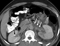 Image result for Genitourinary Trauma