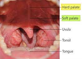 Hard skills are specific professional abilities that can be taught through education and training. Soft Palate Anatomy Soft Palate Function And Soft Palate Cancer