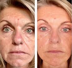 Theres just something about feelint confident in your skin again ✨ bonus if  your hair is growing and thriving too right?🥹 say DEETS ive got a suprise  👇🏻