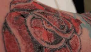 Tattoos are supposed to scab at any stage of the tattoo healing stages and it is very normal for it to scab. Tattoo Scabbing A Healthy Healing Process Tattoo Machine Advisor